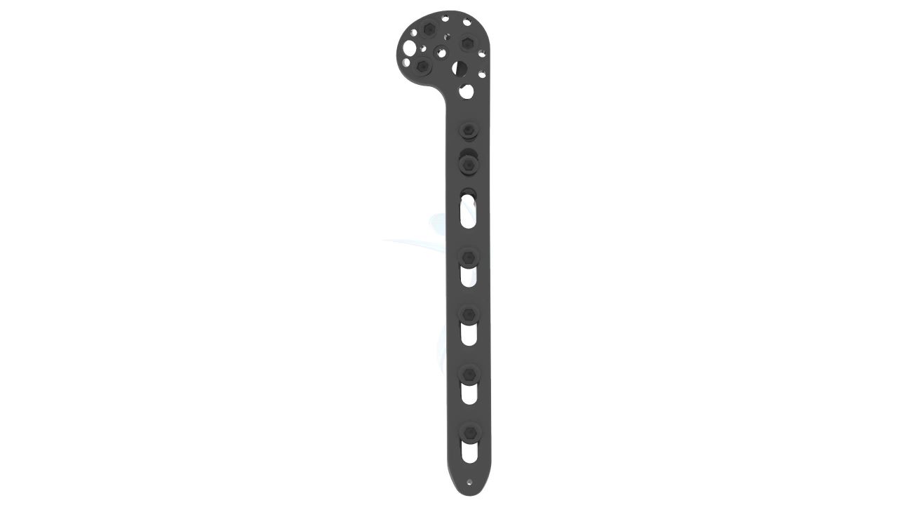 Periarticular Plate