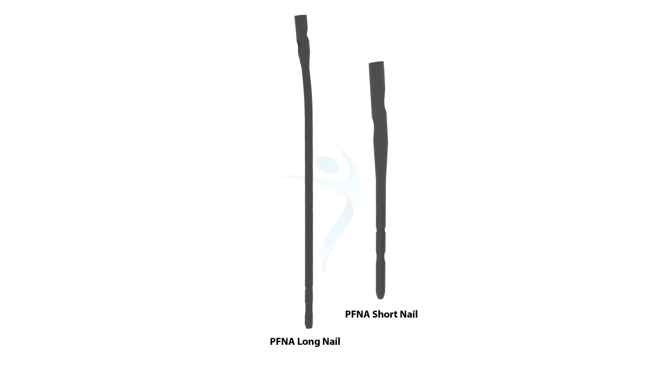 PFNA - Long & Short