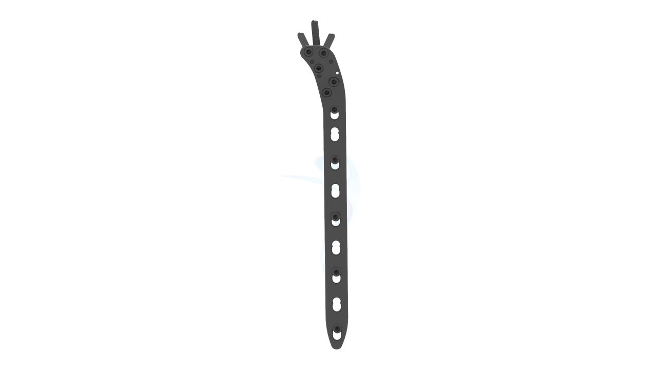 Proximal Tibia Safety Lock Plate