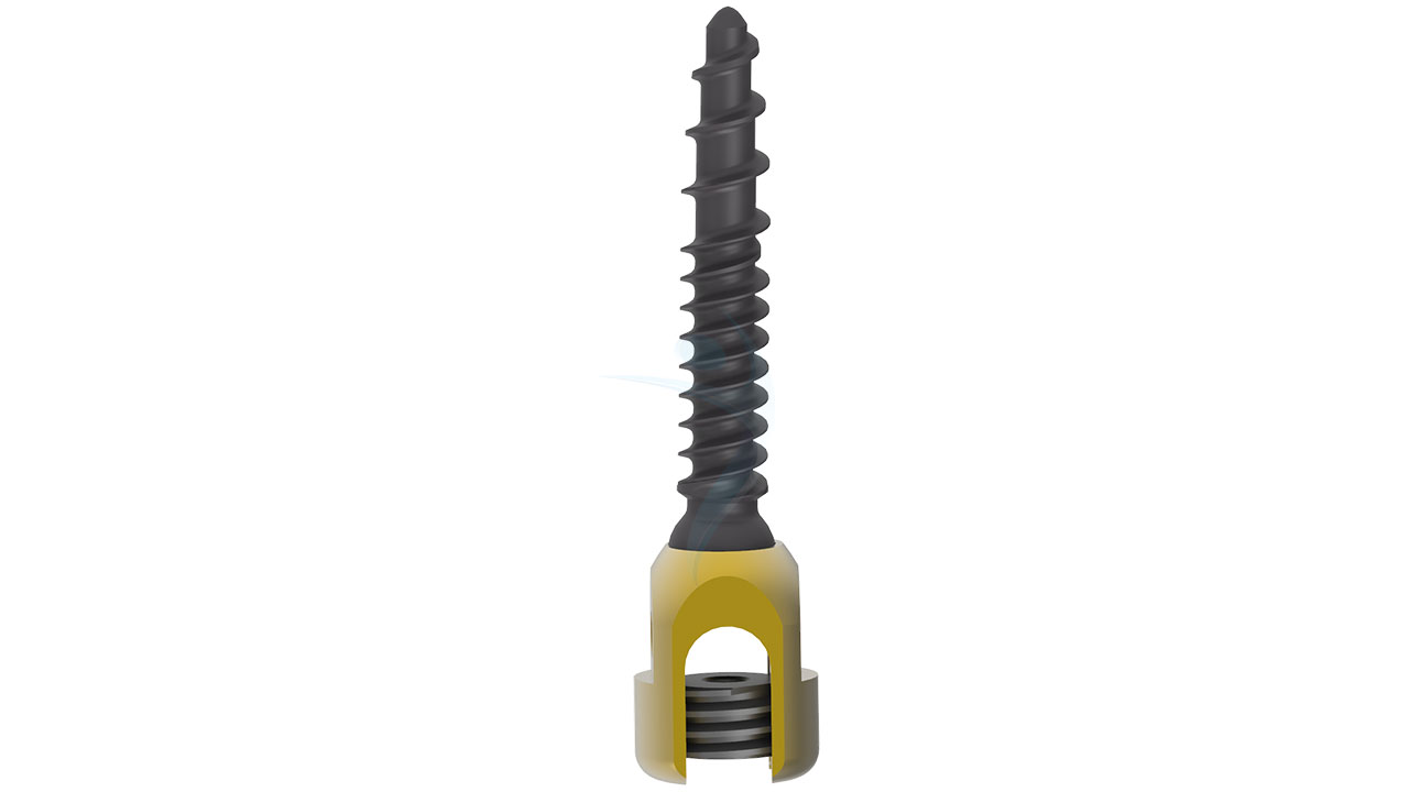 6.2 Pedicle Screw - Poly Axial
