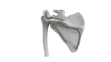 ASLP - 2.7 Scapula Plating System