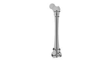 Distal Femur Nail