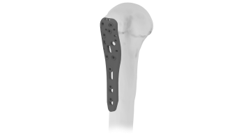 Apulum Plate Proximal Humerus Plate (ASLP) 3.5 mm