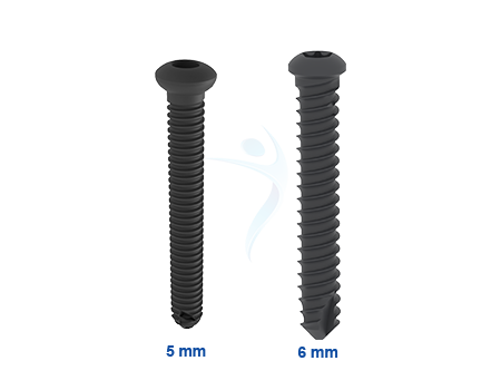 5.0 mm & 6.0 mm Intramedullary Screws