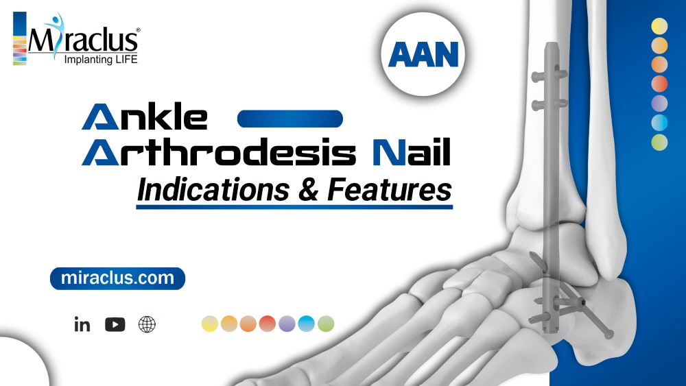 Ankle Arthrodesis Nail Indications & Features