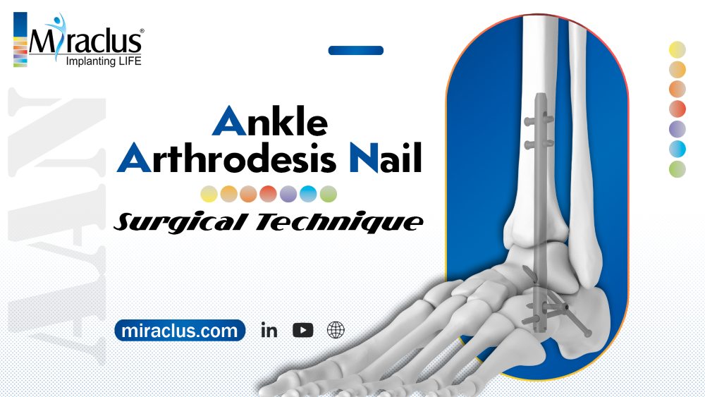Ankle Arthrodesis Nail Surgical Technique