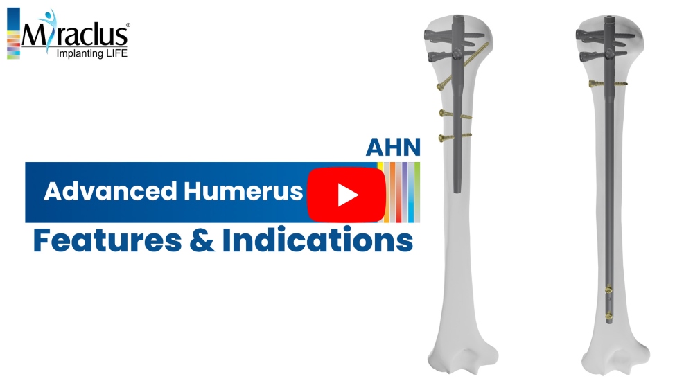Advanced Humerus Nail Indications & Features