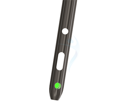 Third distal locking hole : 10° offset (anterolateral to posteromedical) for enhanced fixation options