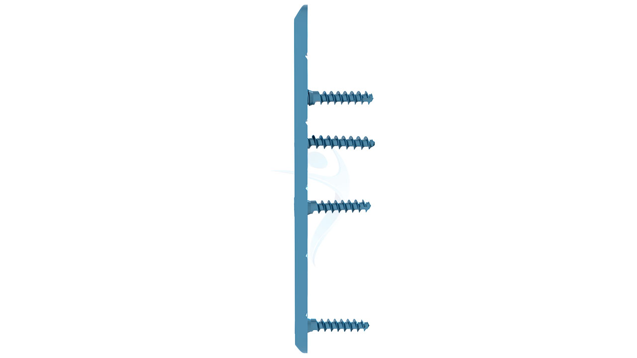1.5 mm Straight Plate ASLP