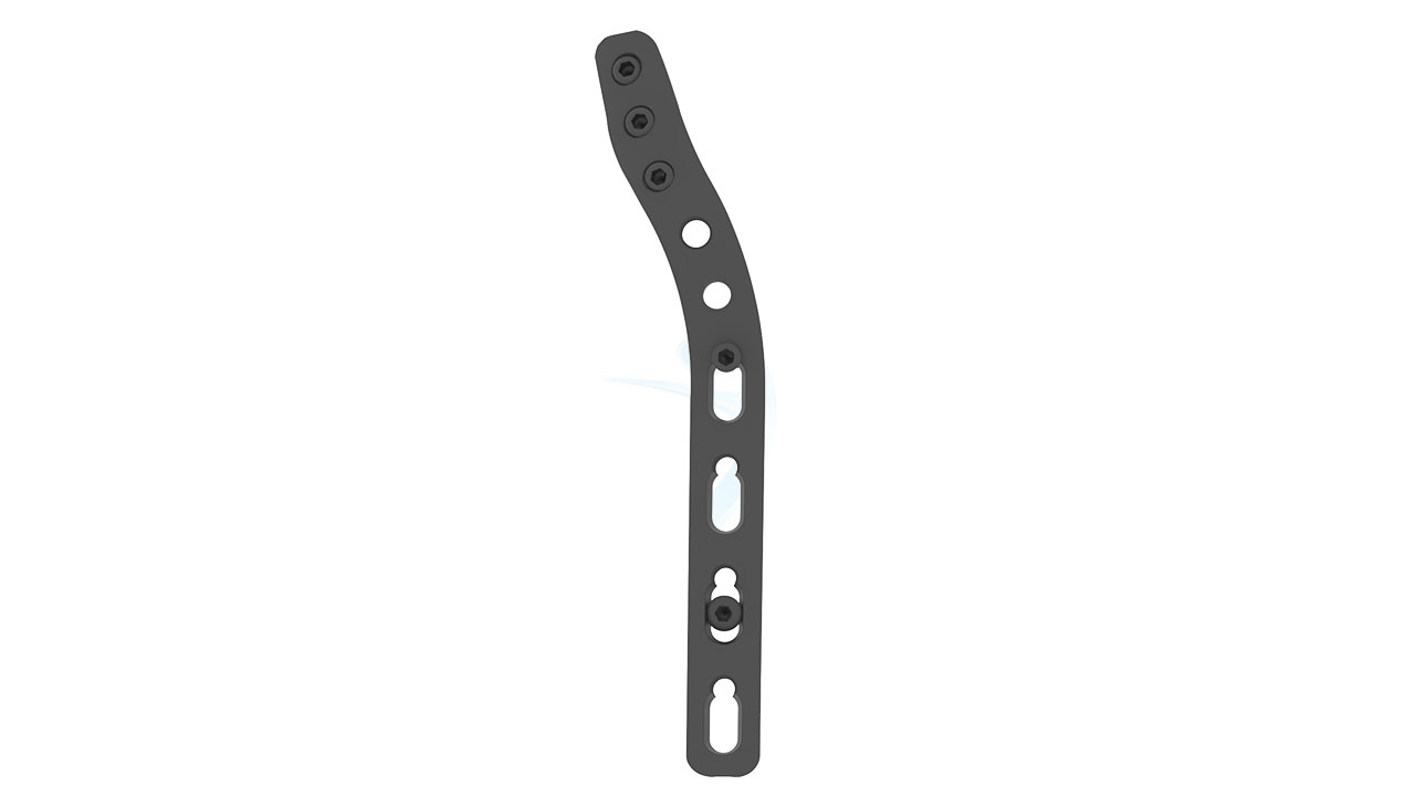 ASLP - 3.5 Distal Humerus Extra Articular Plate