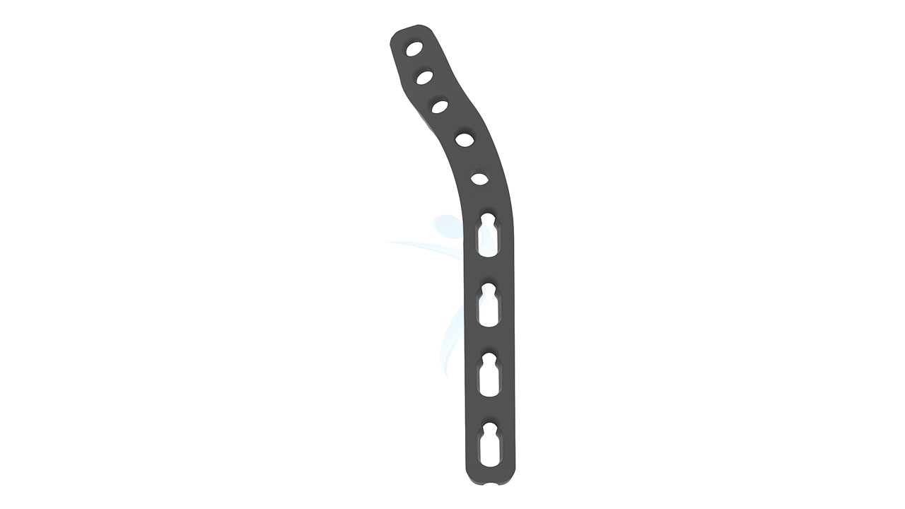 Extra Articular Distal Humerus Locking Plate