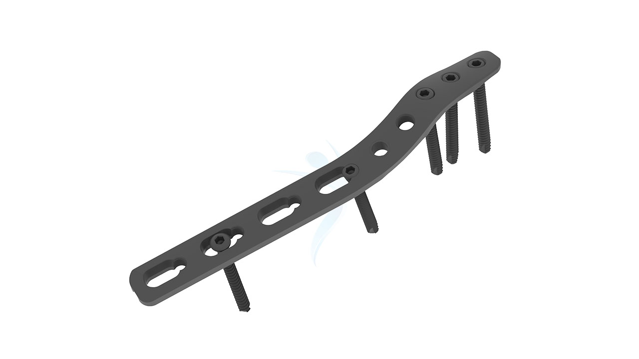 Fixlock Distal Lateral Humerus Extra Articular Plate - 3.5 mm ASLP