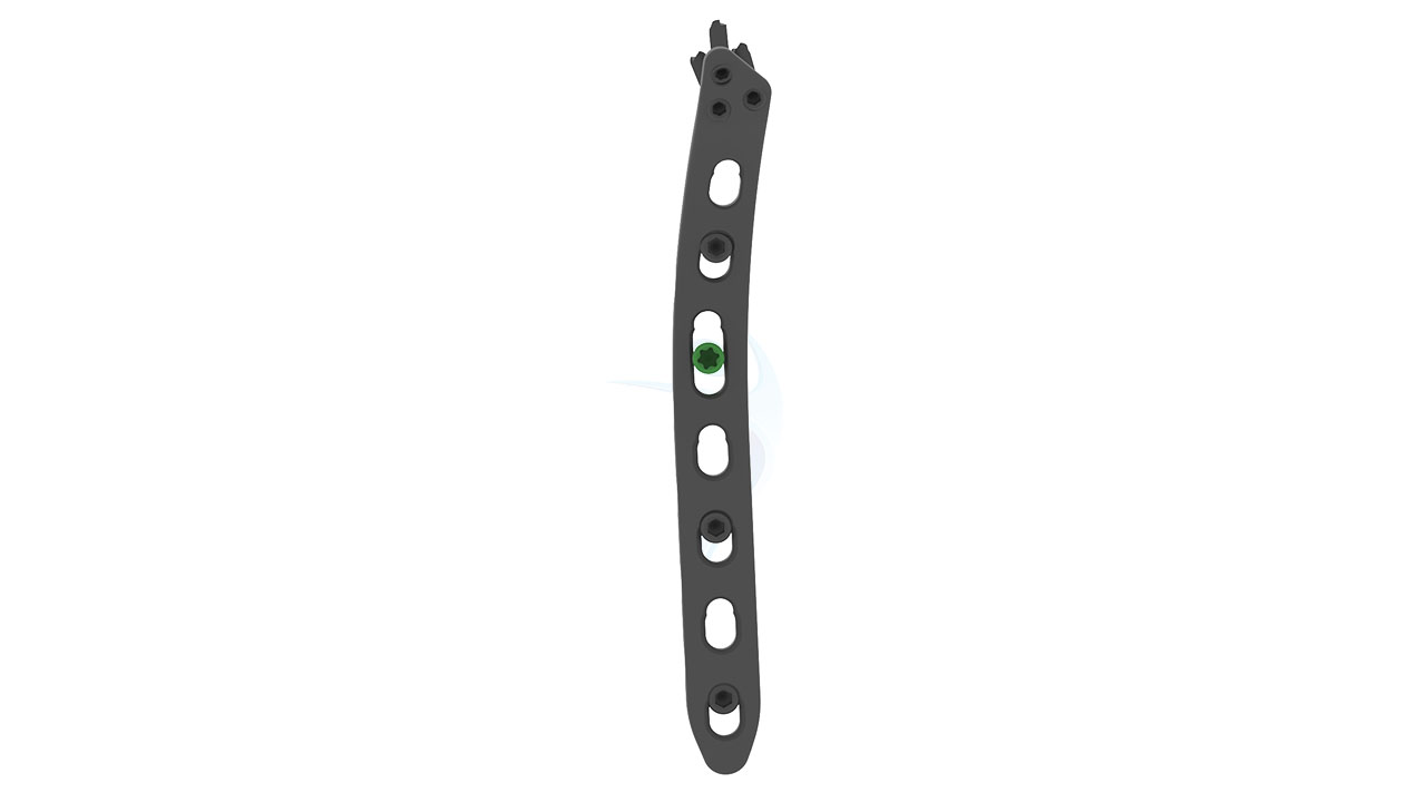2.7 3.5 mm ASLP Distal Humerus Plate Fixlock
