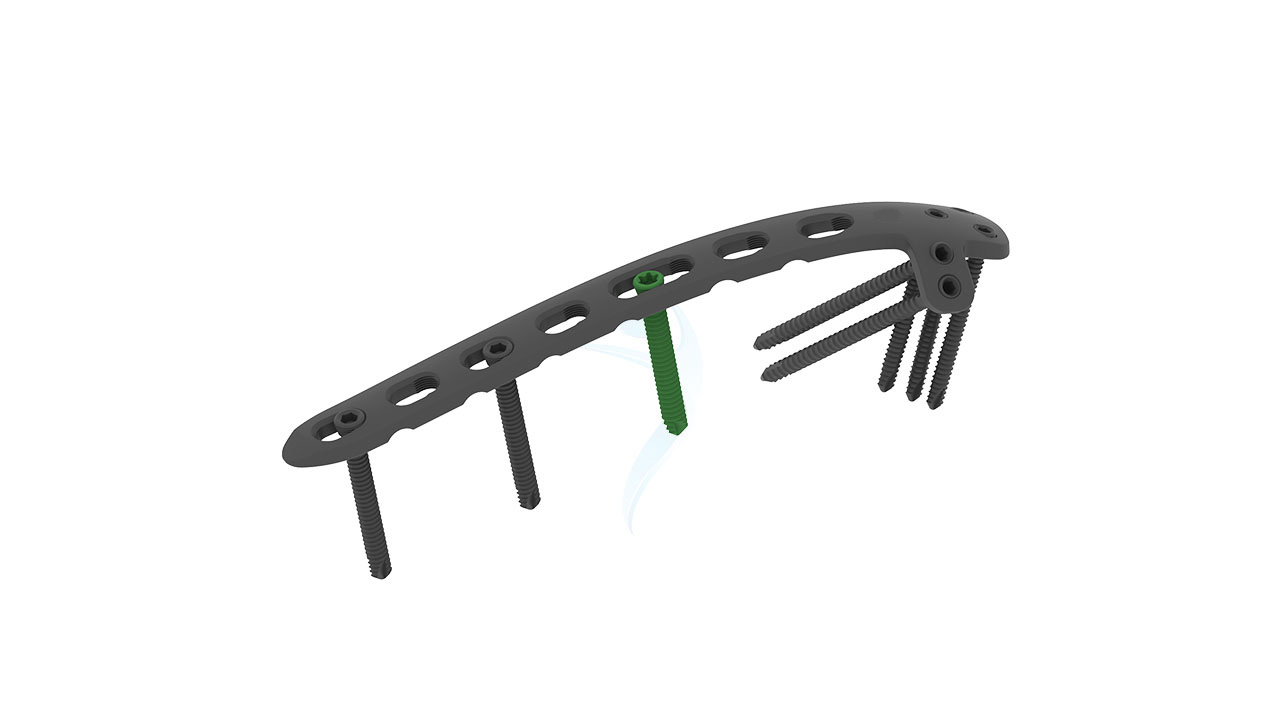 2.7 3.5 mm Posterolateral With Lateral Support Plate
