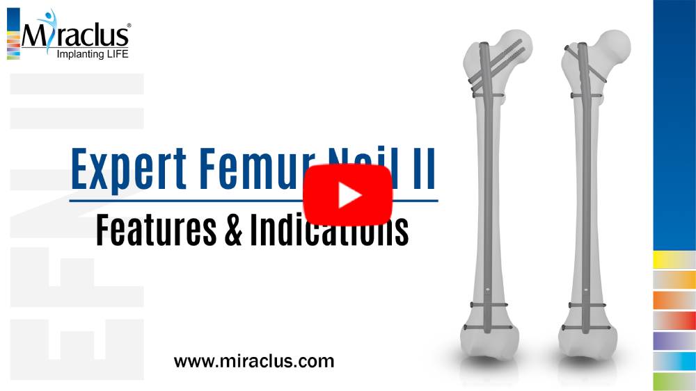 Expert Femur Nail II Indications & Features