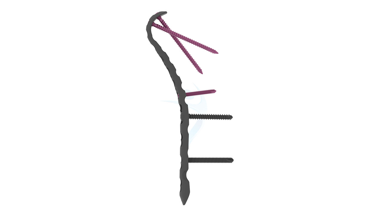 2.7 3.5 VA LCP Extended Medial Distal Humerus Plate