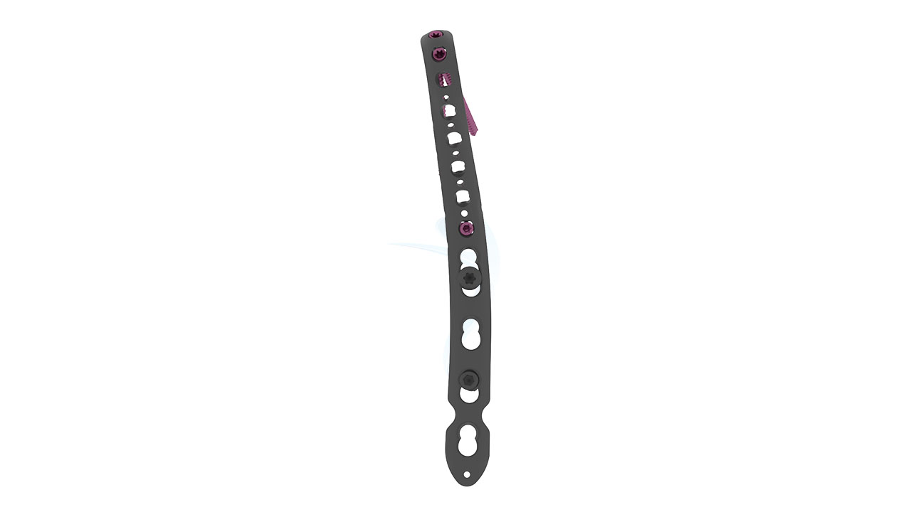 Distal Humerus (VALP) Extended Medial Fixlock Plate