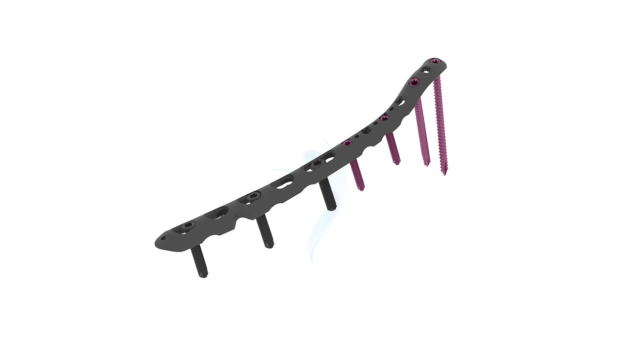 VALP - 2.7 mm Lateral Distal Humerus Plate