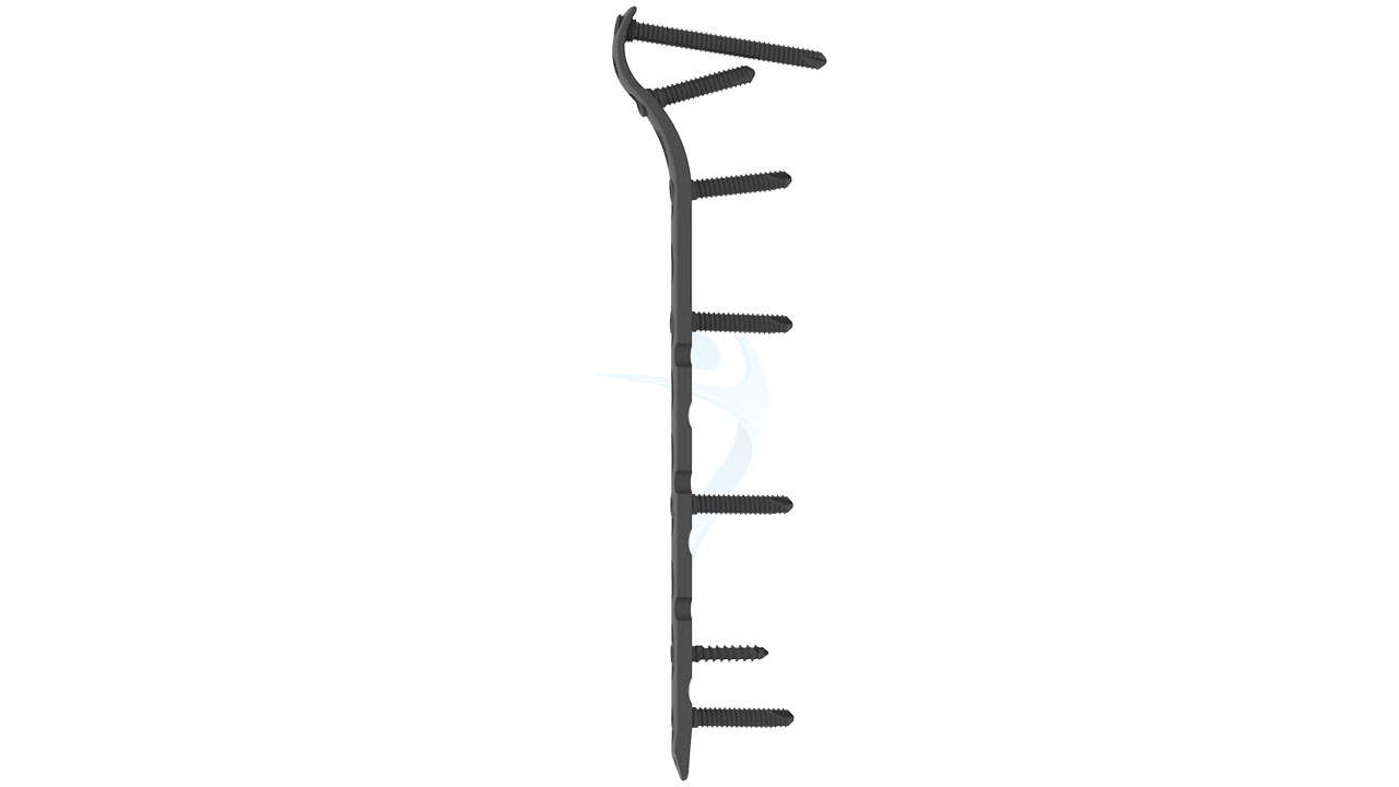 3.5 mm Metaphyseal Plate ASLP Elbow