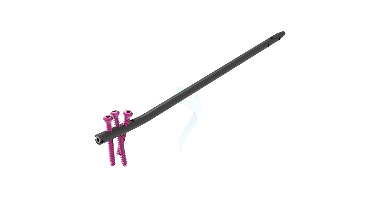 Multiloc Nail Humerus Nail Multi lock Interlocking Nail