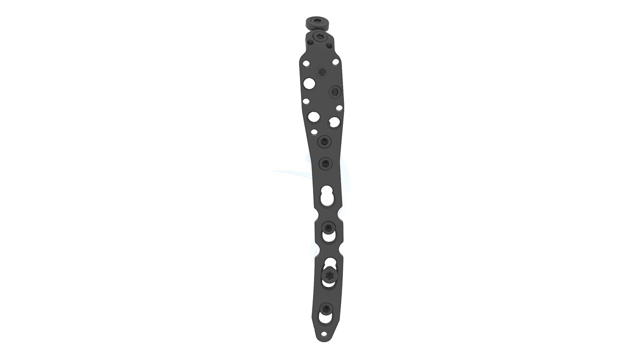 ASLP - 3.5 Olecranon Plate