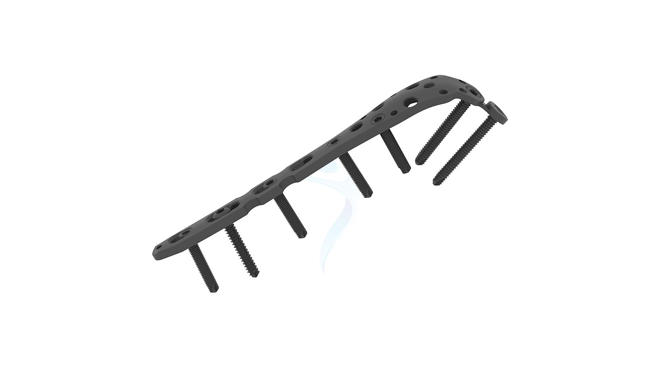Olecranon Safety Lock Plate