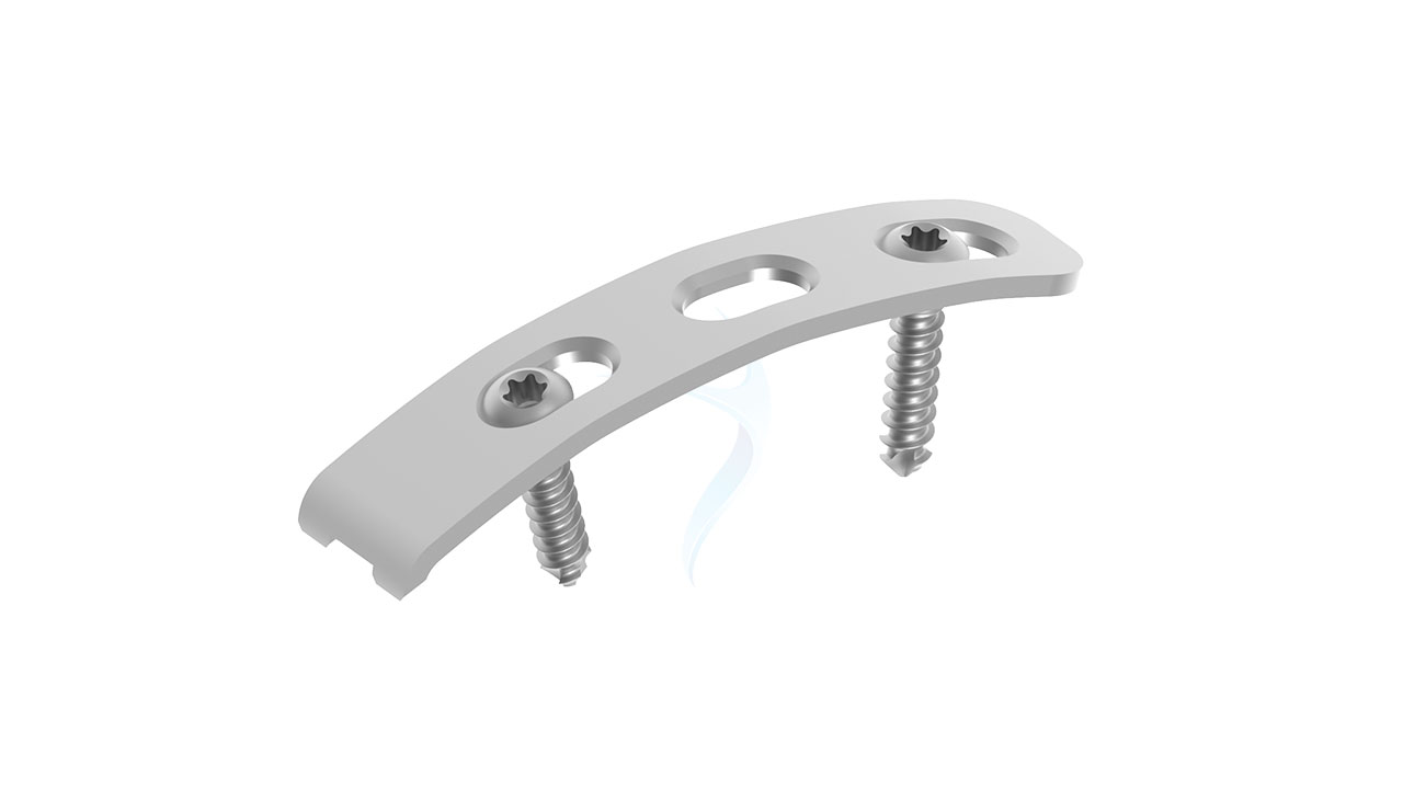 Pelvic Spring Plate for Reduction