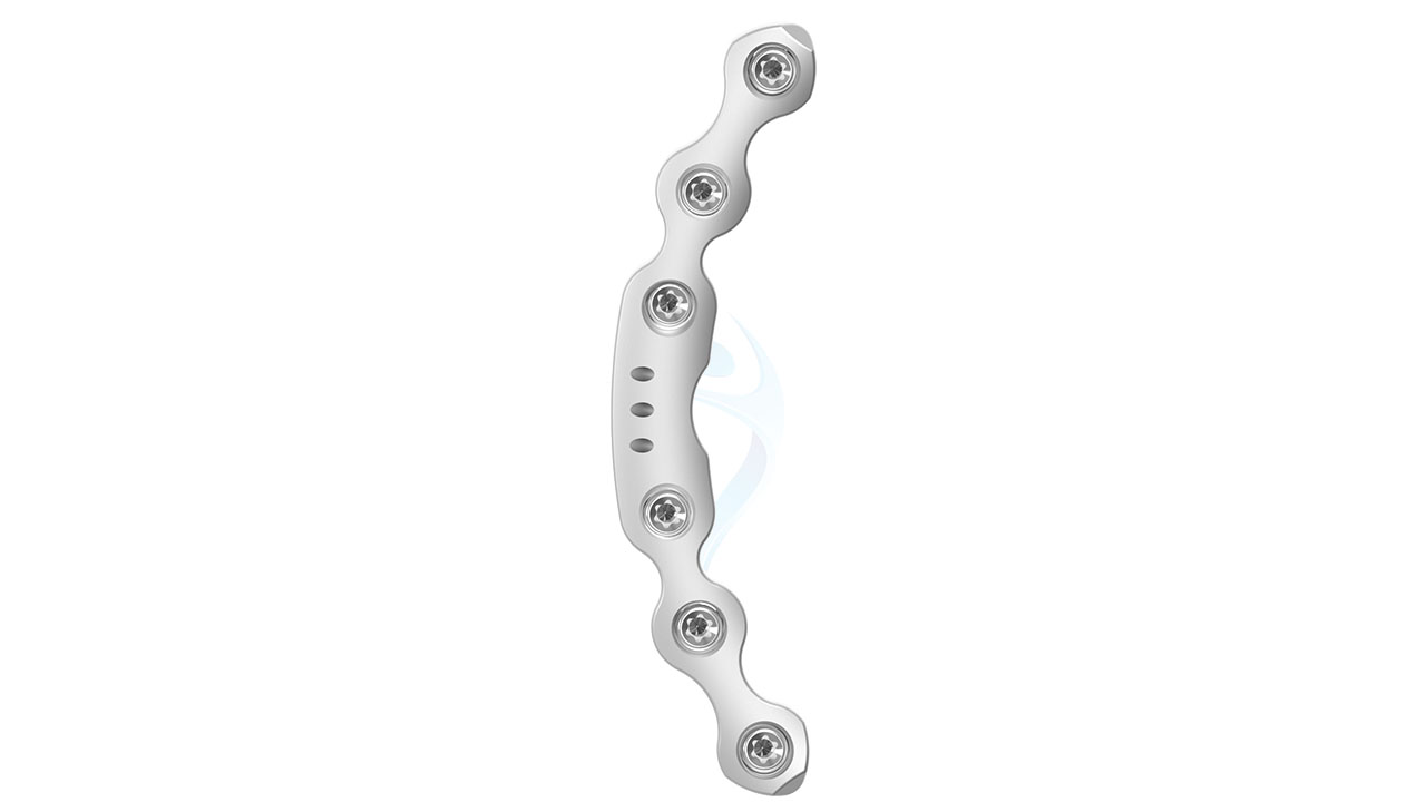 Locking 3.5 mm Pelvic Symphyseal Plate