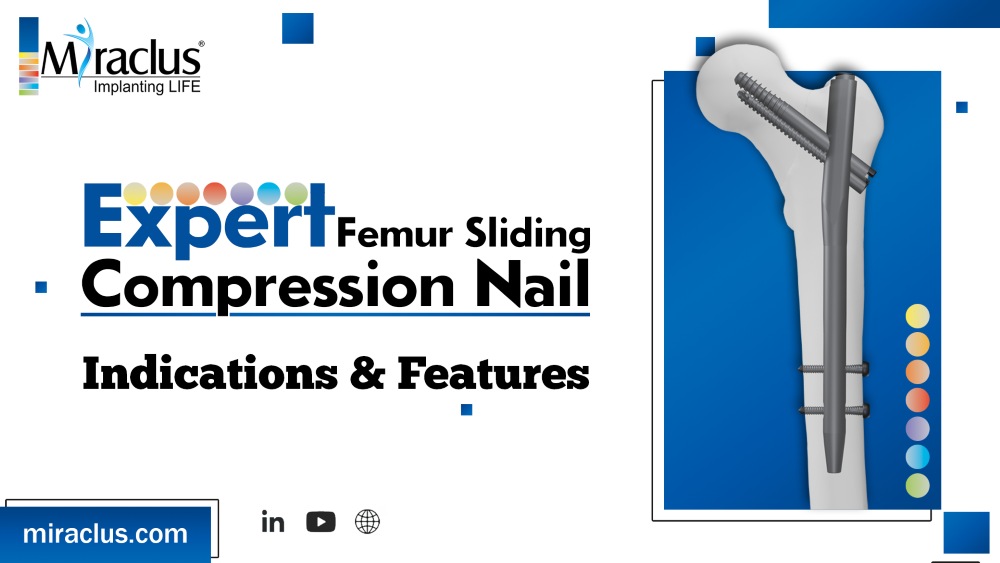 Expert Femur Sliding Compression Nail Indications & Features