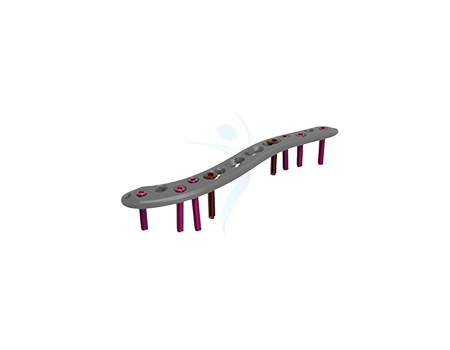 Clavicle Plate with 2.7 Locking Screw