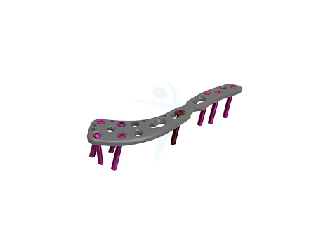 VALP - 2.7 Clavicle Plating System