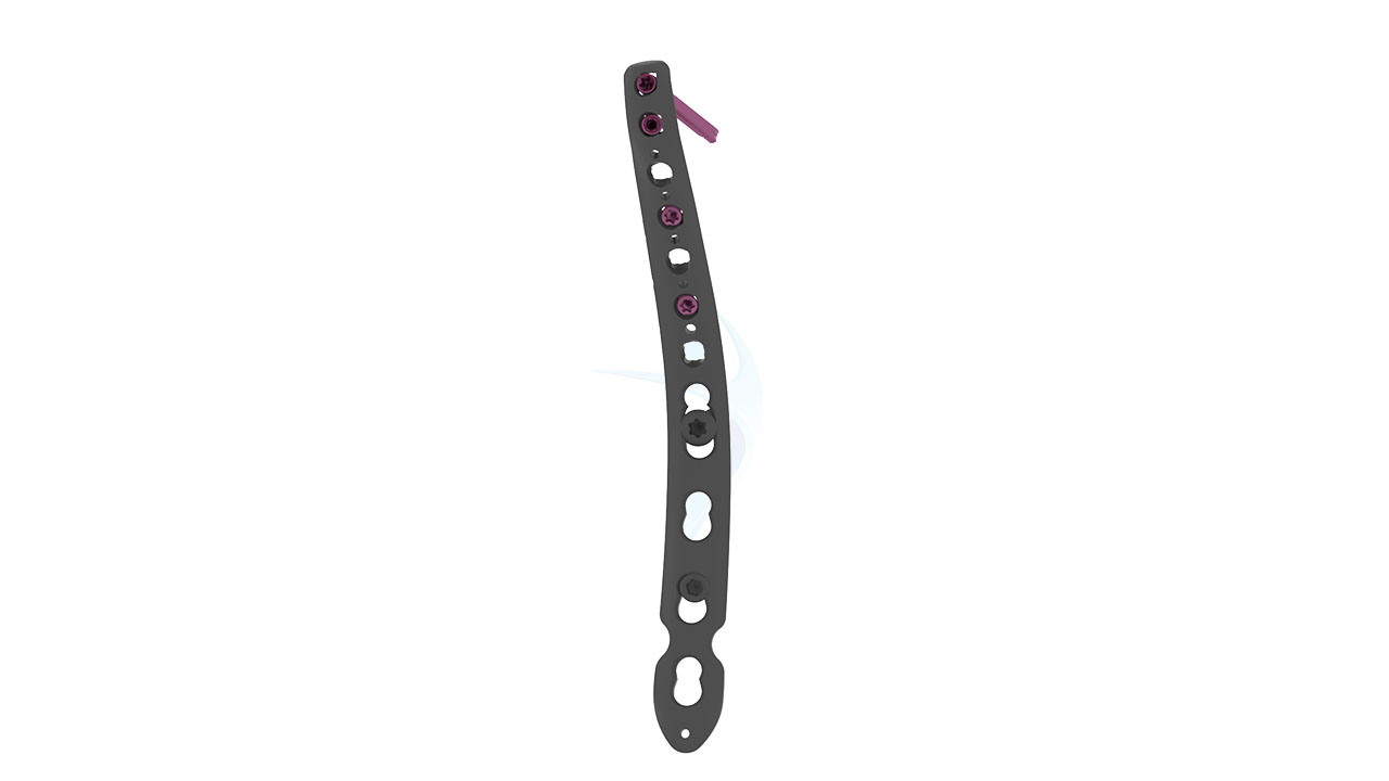 Variable Angle Locking Medial Distal Humerus Plate - 2.7 mm