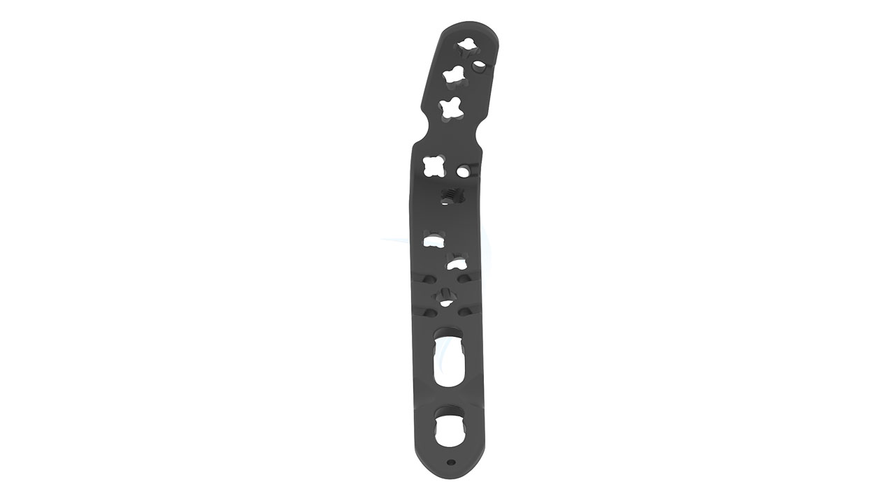 Proximal Olecranon Variable Angle Locking Plate